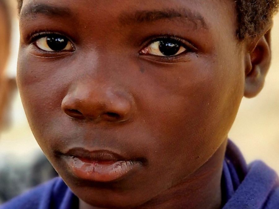 Enfant au Malawi